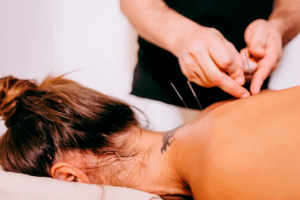 FAC DAY SPA - PIC's e Acupuntura (Data: 21/11) (08:00h às 11:00h)